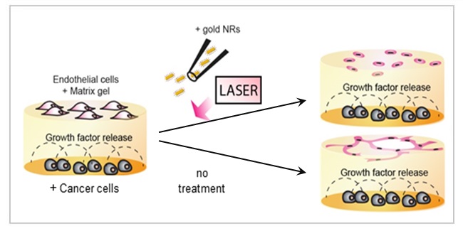 Nanoparticles for inhibition of tumour angiogenesis